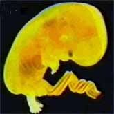 An embryo undergoes rapid development and neural pruning.